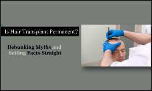 Myths of hair Transplant