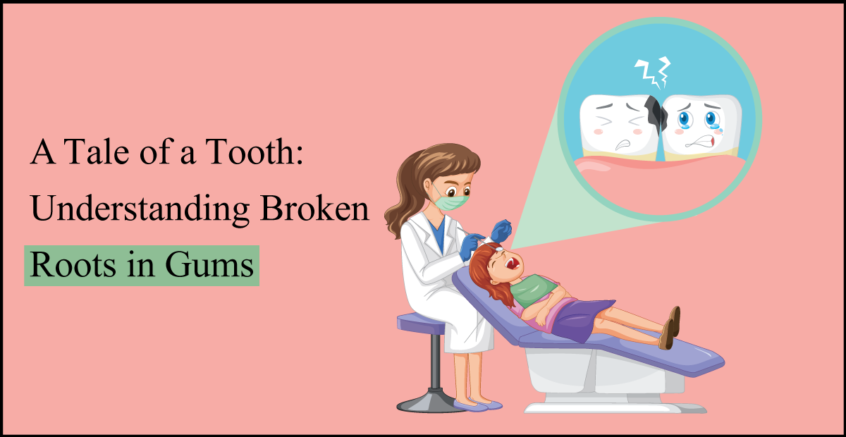 A Tale of Tooth: Understanding Broken tooth Roots in Gums